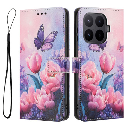 Xiaomi 17T Pro Tulpen Case